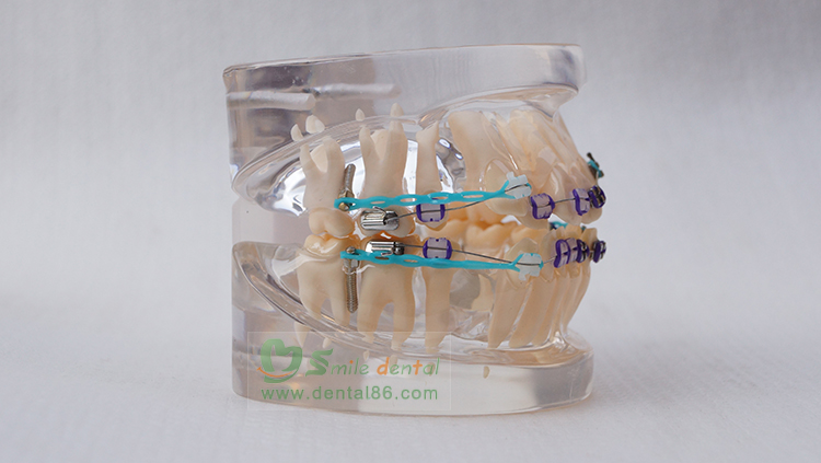 TM-B2-02 Orthodontic Model